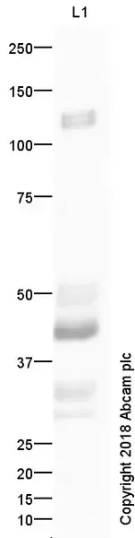 Anti-VE Cadherin antibody - Intercellular Junction Marker(AB33168)