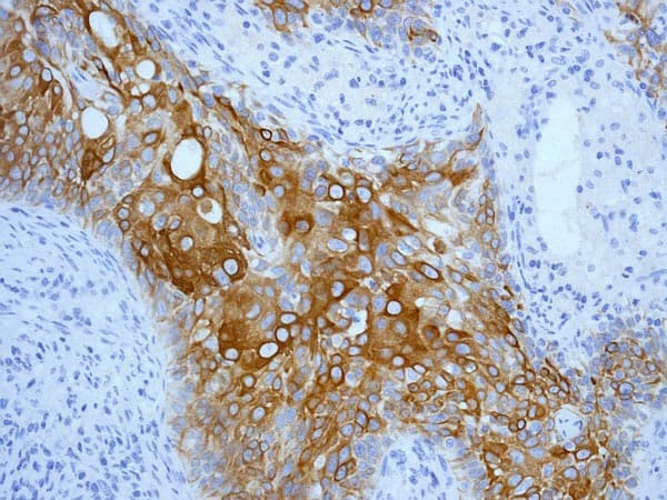 Cytokeratin 17 Antibody Ep1623 Bsa And Azide Free Ab239986  Immunohistochemistry Formalin Pfa Fixed Paraffin Embedded Sections Img138150