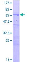 Recombinant Human WIPF1 protein(AB132512)