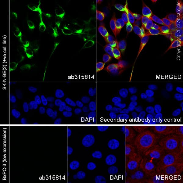 68kda Neurofilament Nf L C Term Antibody Epr28784 63 Bsa And Azide Free Ab315815  Immunocytochemistry Immunofluorescence Img425499