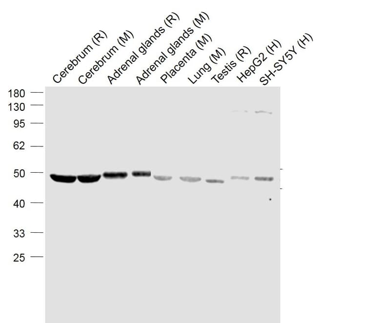 Anti-Nicotinic Acetylcholine Receptor alpha 7 antibody(AB216485)