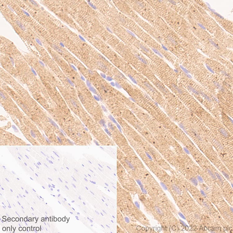 Anti-Cofilin 2 antibody [EPR24519-7](AB300128)