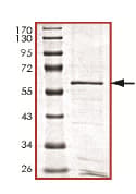 Recombinant human PPP1A/PPP1CA protein(AB128559)