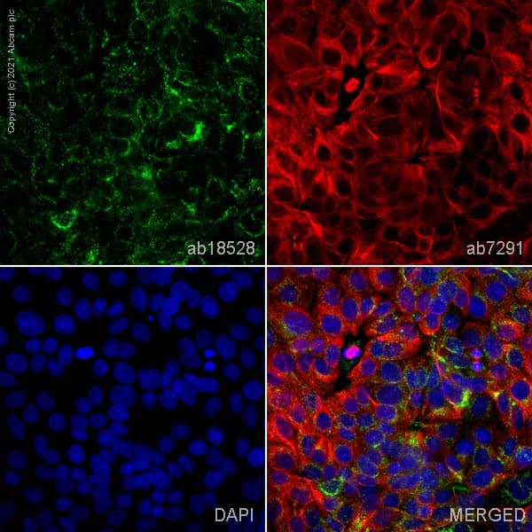 Anti-LAMP2A antibody - Lysosome Marker(AB18528)