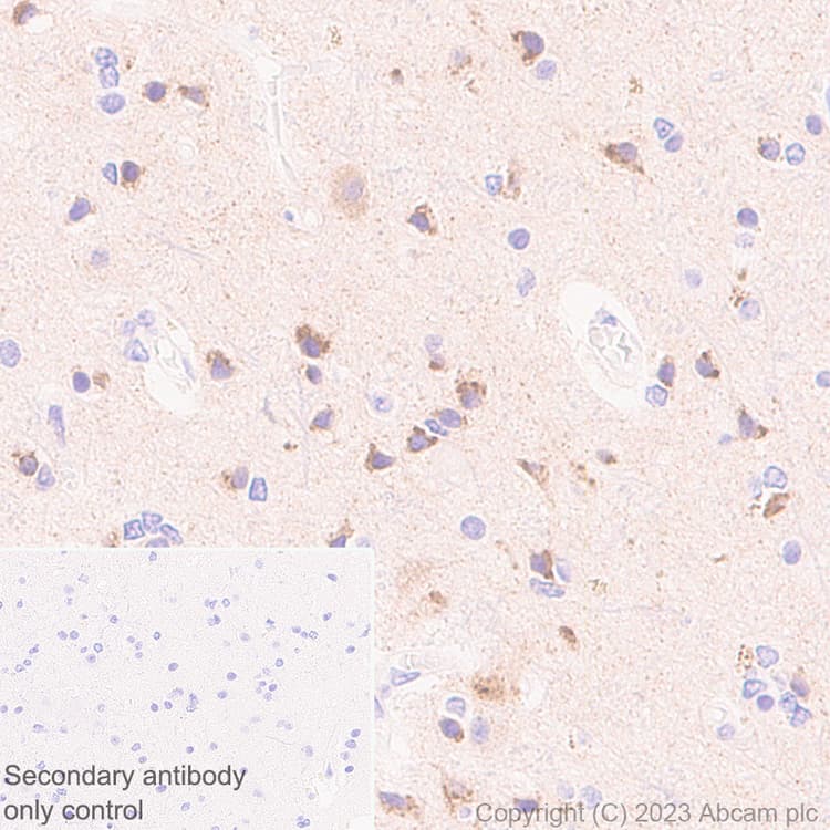 Anti-Sez6 antibody [EPR28518-55](AB314233)