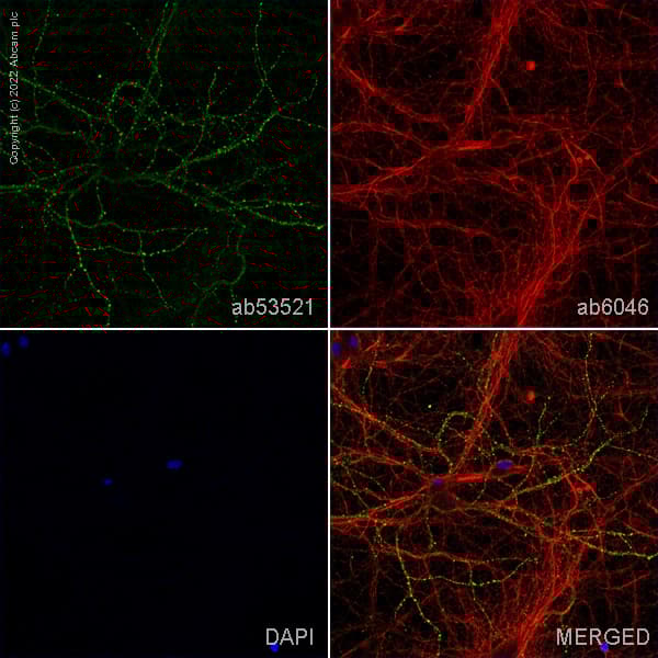 Anti-beta Tubulin antibody - Loading Control(AB6046)