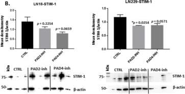 Anti-Stromal interaction molecule 1 antibody [5A2](ab57834)