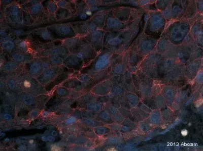 Anti-N Cadherin antibody - Intercellular Junction Marker(AB18203)