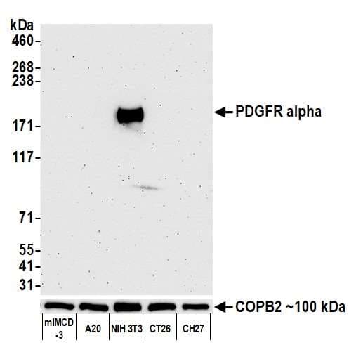 Pdgfr Alpha Antibody Blr128h Bsa Free Ab314105  Western Blot Img420676