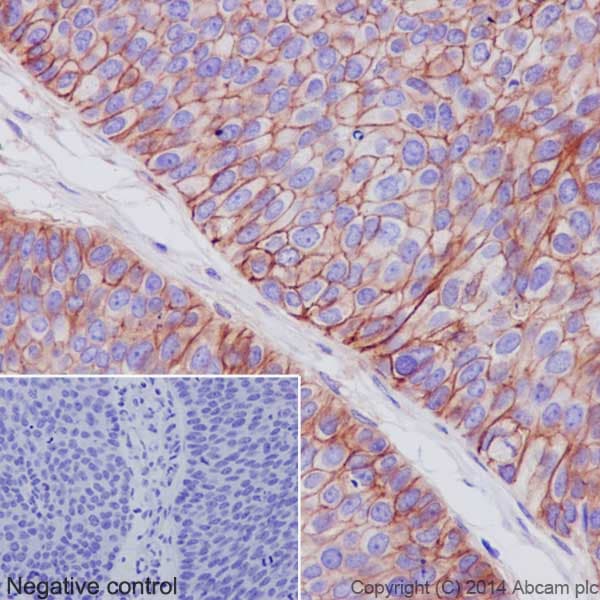 Anti-Integrin alpha V antibody [EPR16800](AB179475)