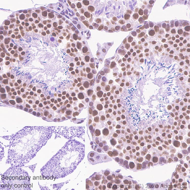 Anti-YTHDC1 antibody [EPR21821-213](AB259990)