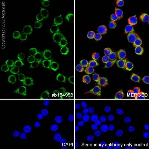 Anti-Collagen III antibody [EPR17673](AB184993)
