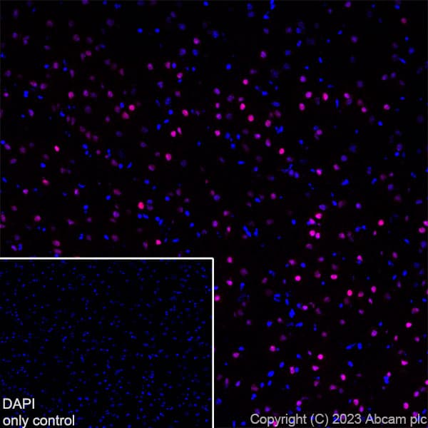 Alexa Fluor® 647 Anti-TBR1 antibody [EPR8138(2)](AB314473)