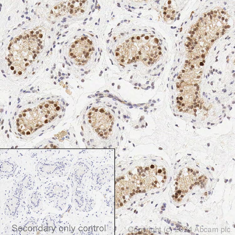 Anti-CDKN2A/p16INK4a antibody [EPR1473] - C-terminal(AB108349)