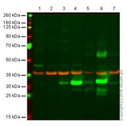 Anti-Heme Oxygenase 1 antibody [HO-1-1](AB13248)