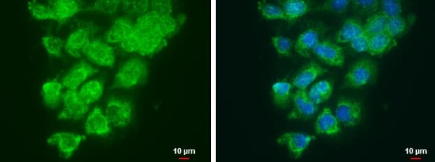 Loxl2 Antibody Ab96233  Immunocytochemistry Immunofluorescence Img114723