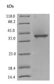 Recombinant DNA polymerase IV protein(AB238357)