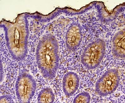 Anti-CEACAM5 + CEACAM6 antibody [NCRC16 (AKA 161)](AB22705)