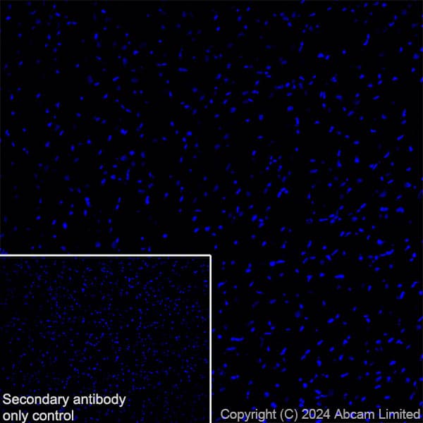 Anti-TBR2 / Eomes antibody [RM2055](AB319166)