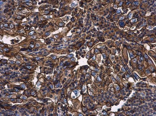 Beta 2 Microglobulin Antibody Ab227261  Immunohistochemistry Formalin Pfa Fixed Paraffin Embedded Sections Img105945