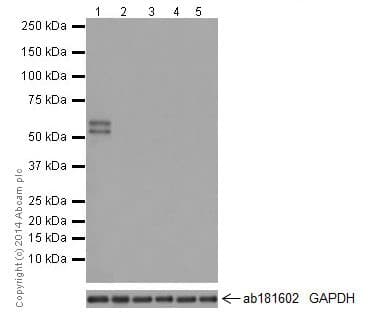 Rbmy1a1 Antibody R125082 Ab200202  Western Blot Img147007