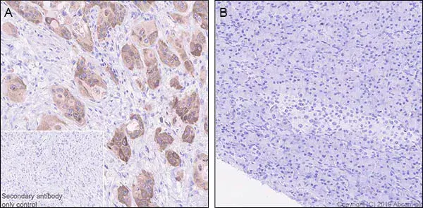 Anti-LINE-1 ORF1p antibody [EPR22227-54](AB230966)