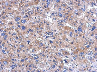 Fastkd5 Antibody Ab111548  Immunohistochemistry Formalin Pfa Fixed Paraffin Embedded Sections Img128768