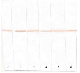 Probnp Antibody 5b6 Ab13111  Western Blot Img145956