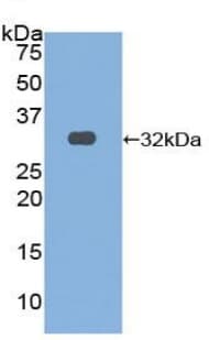 Osmr Antibody Ab232684  Western Blot Img137130