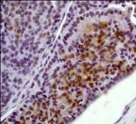 Anti-Erk1 (pT202/pY204) + Erk2 (pT185/pY187) antibody [E337] - BSA and Azide free(AB232017)