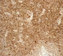 Tppp Antibody Epr3315 Ab119987  Immunohistochemistry Formalin Pfa Fixed Paraffin Embedded Sections Img127312