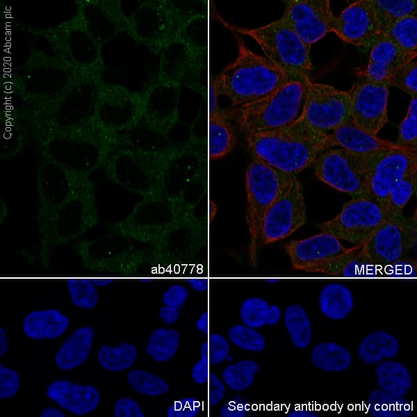 Anti-APC antibody [EP701Y](AB40778)