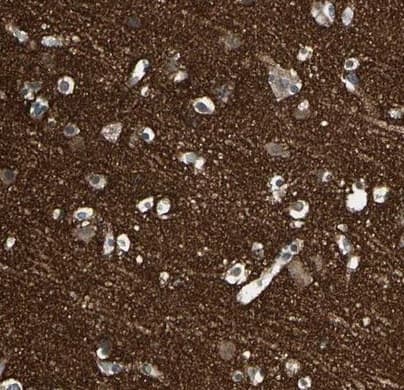 Sv2a Antibody Ab224073  Immunohistochemistry Formalin Pfa Fixed Paraffin Embedded Sections Img40267