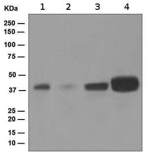 Anti-Islet 1 antibody [EP4182] - Neural Stem Cell Marker(AB109517)