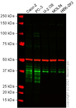 Dkk1 Antibody Epr4759 Ab109416  Western Blot Img175058
