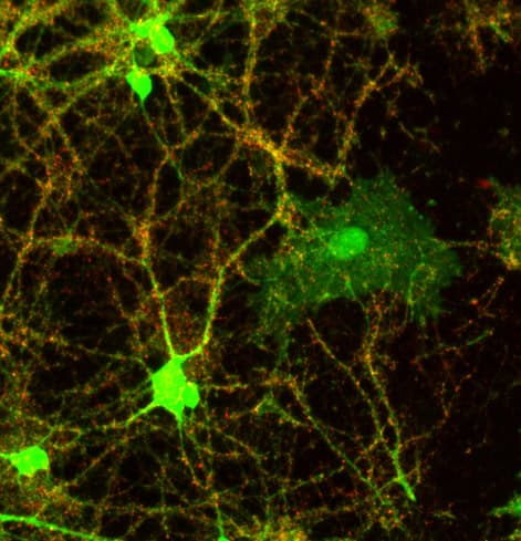 Synaptophysin Antibody Synaptic Marker Ab32594  Immunocytochemistry Immunofluorescence Img53898