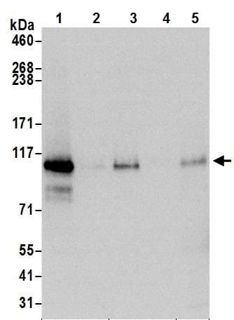 Anti-HIF-2-alpha antibody [BL-95-1A2](AB243861)
