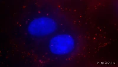 Anti-Adenovirus Type 5 antibody(ab6982)
