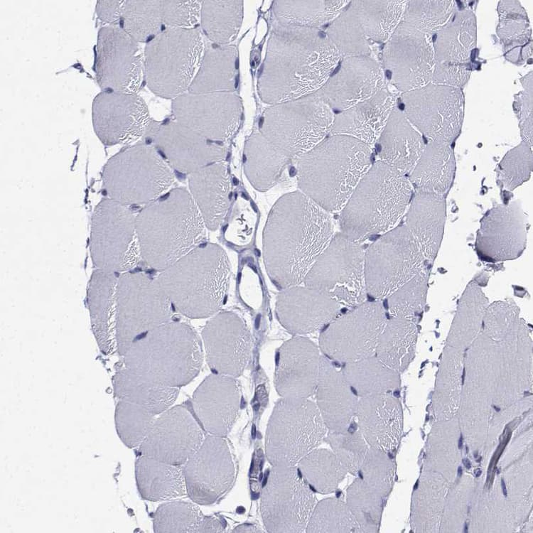 Flj23834 Antibody Ab121337  Immunohistochemistry Formalin Pfa Fixed Paraffin Embedded Sections Img40525