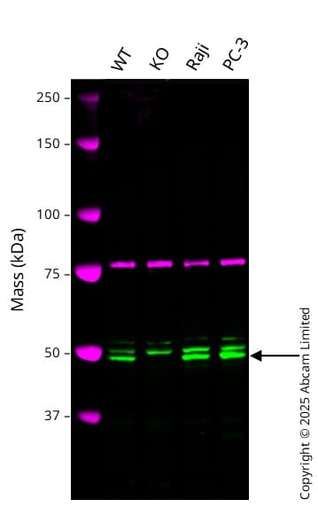 Anti-HERPUD1 antibody [EPR9649](AB150424)