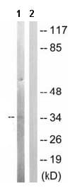 Anti-Casein Kinase 1 alpha (phospho T321) antibody(AB63559)