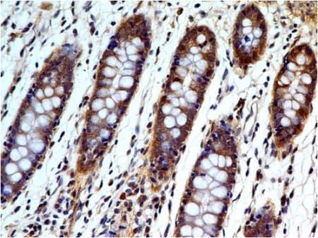 Caspase 3 Antibody Abm1c12 Ab208161  Immunohistochemistry Formalin Pfa Fixed Paraffin Embedded Sections Img130410