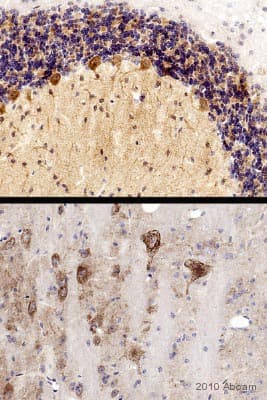 Anti-PSD95 antibody - Synaptic Marker(AB18258)