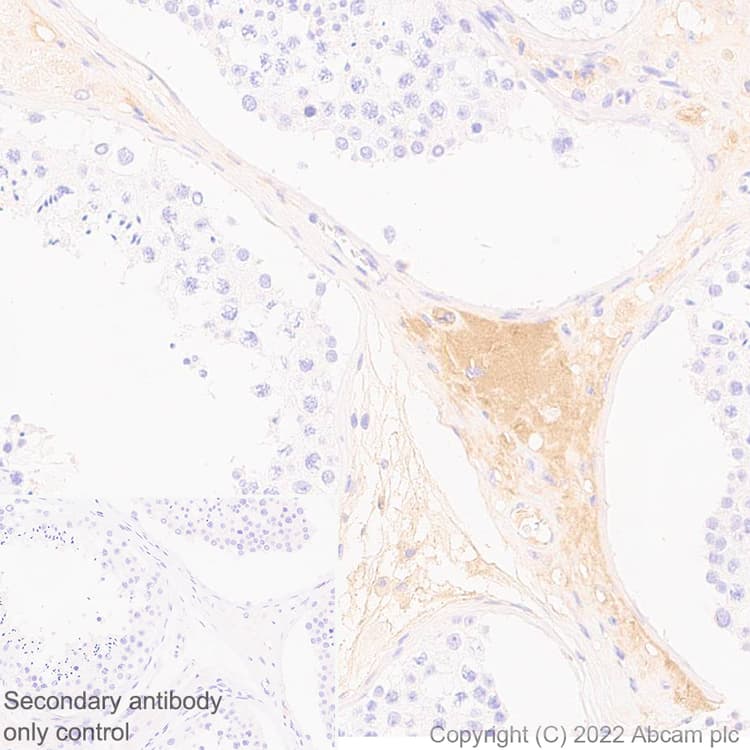 Complement Factor B Antibody Epr27443 6 Bsa And Azide Free Ab309150  Immunohistochemistry Formalin Pfa Fixed Paraffin Embedded Sections Img409466