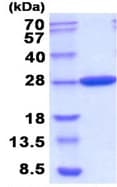 Recombinant E. coli Carbonic anhydrase 2/CA2 protein(AB208309)