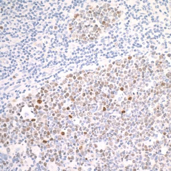 Ki67 Antibody Blr021e Ab243878  Immunohistochemistry Formalin Pfa Fixed Paraffin Embedded Sections Img170842