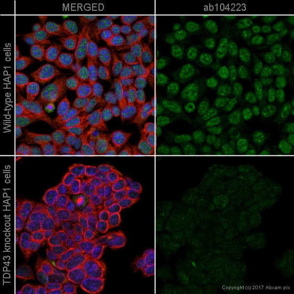 Anti-TDP43 antibody [3H8](AB104223)