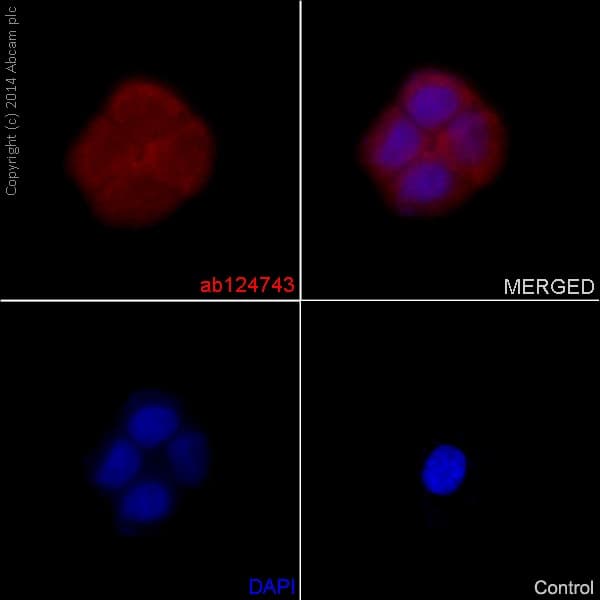 Anti-S100P antibody [EPR6142](AB124743)