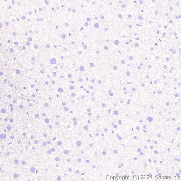 Aire Antibody Epr24411 22 Bsa And Azide Free Ab283663  Immunohistochemistry Formalin Pfa Fixed Paraffin Embedded Sections Img174118