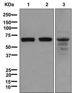 Rpe65 Antibody Epr7024n C Terminal Ab175936  Western Blot Img66074